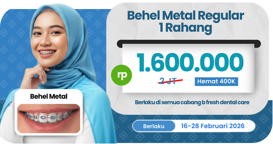Behel Metal Regular
